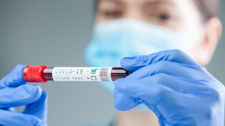 A person wearing a mask and gloves holds a blood sample tube labeled "COVID-19 blood test," with a positive result indicated, as doctors prepare to explore convalescent plasma treatment options.