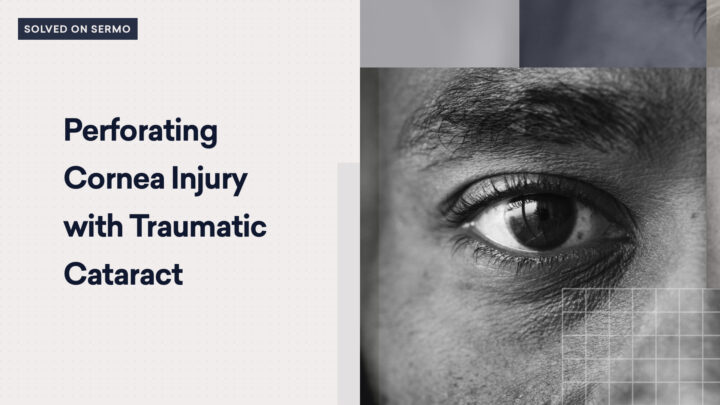 Close-up of a person's eye with the text "Perforating Cornea Injury with Traumatic Cataract" on the left side, featured in the June 2021 edition, highlighting cases solved on Sermo.