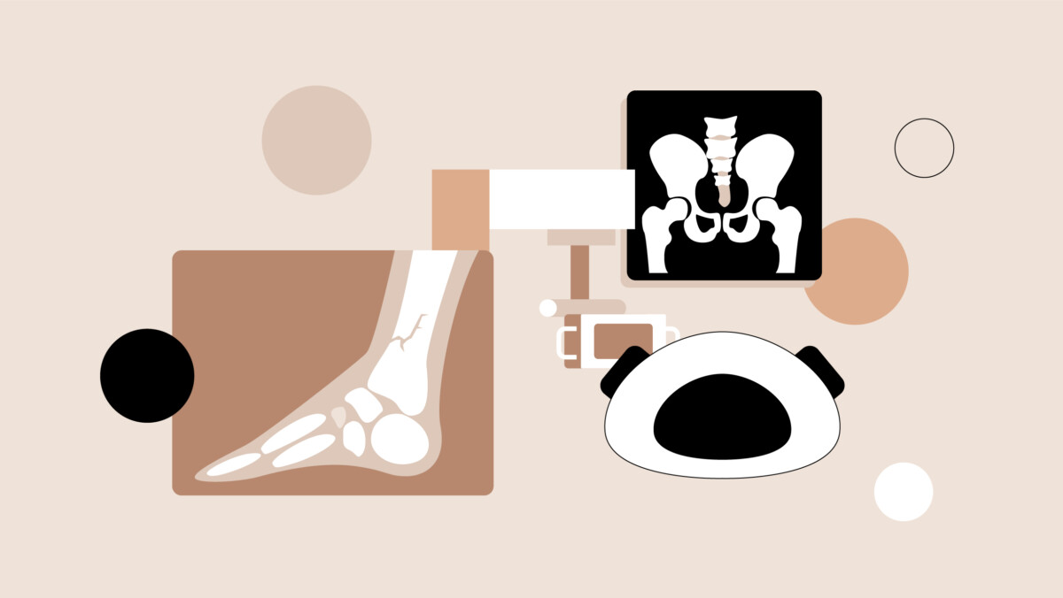 Abstract illustration of medical imaging featuring an X-ray of a fractured ankle, a pelvis X-ray, and an MRI machine, highlighting the role of artificial intelligence in radiology against a beige background with geometric shapes.