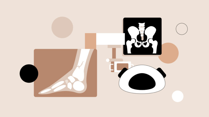 Abstract illustration of medical imaging featuring an X-ray of a fractured ankle, a pelvis X-ray, and an MRI machine, highlighting the role of artificial intelligence in radiology against a beige background with geometric shapes.