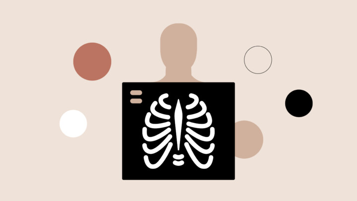 Abstract illustration of a person holding a chest X-ray image showing white ribs, enhanced by advanced medical imaging, with circular shapes in the background on a beige surface.