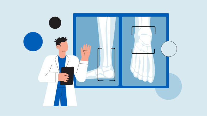 Illustration of a doctor holding a clipboard and pointing at X-ray images of a foot and ankle, highlighting opportunities for earning from expertise beyond the clinic.