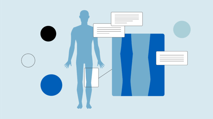 Illustration of a human silhouette with a magnified view of a leg, text boxes detailing sarcoma treatments, and several colored circles on a light blue background.
