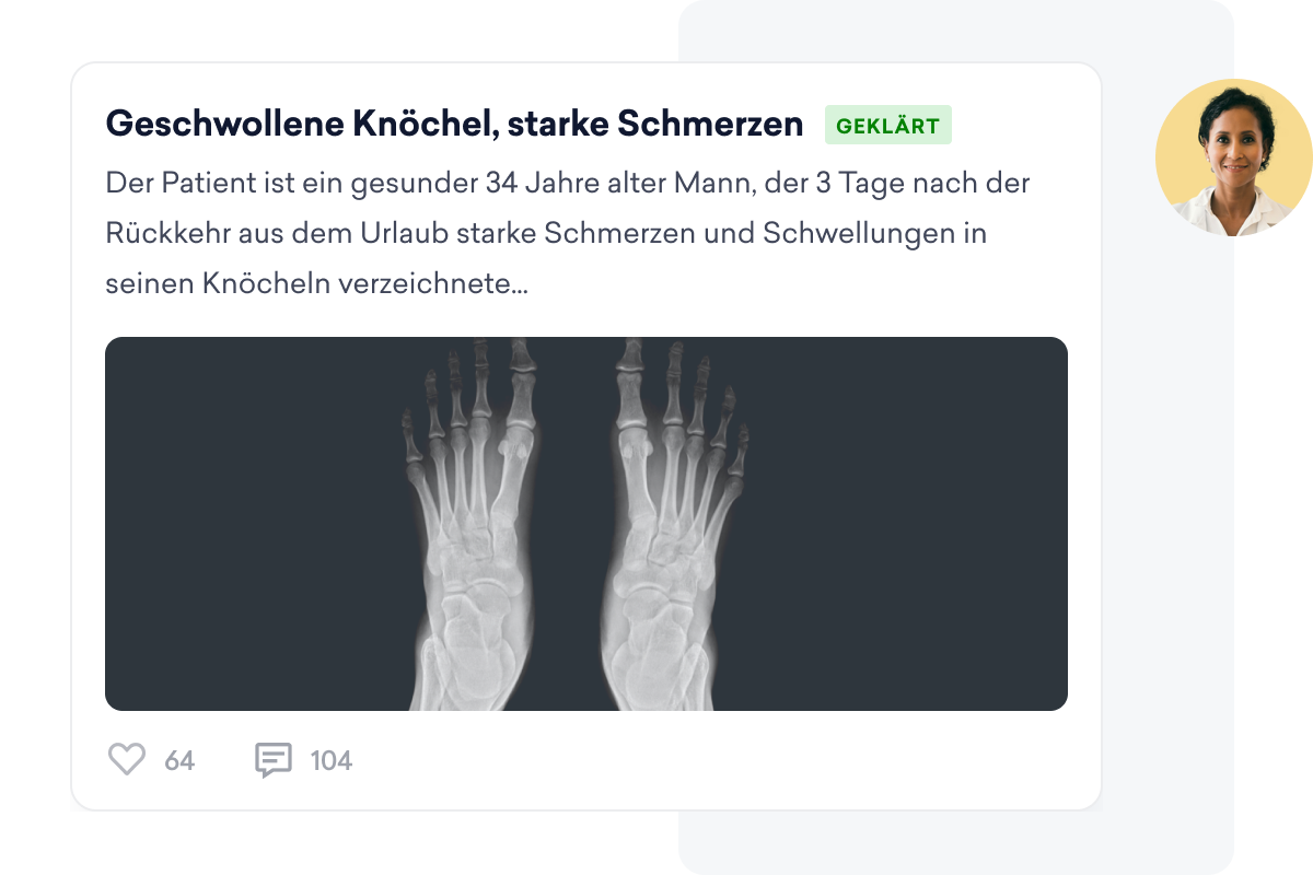 Das Röntgenbild zweier Füße zeigt eine Krankenakte über einen 34-jährigen Mann mit starken Schmerzen und Schwellungen im Knöchel nach dem Urlaub, geteilt im Sozialen Netzwerk für Ärzt*innen für professionelle Einblicke.