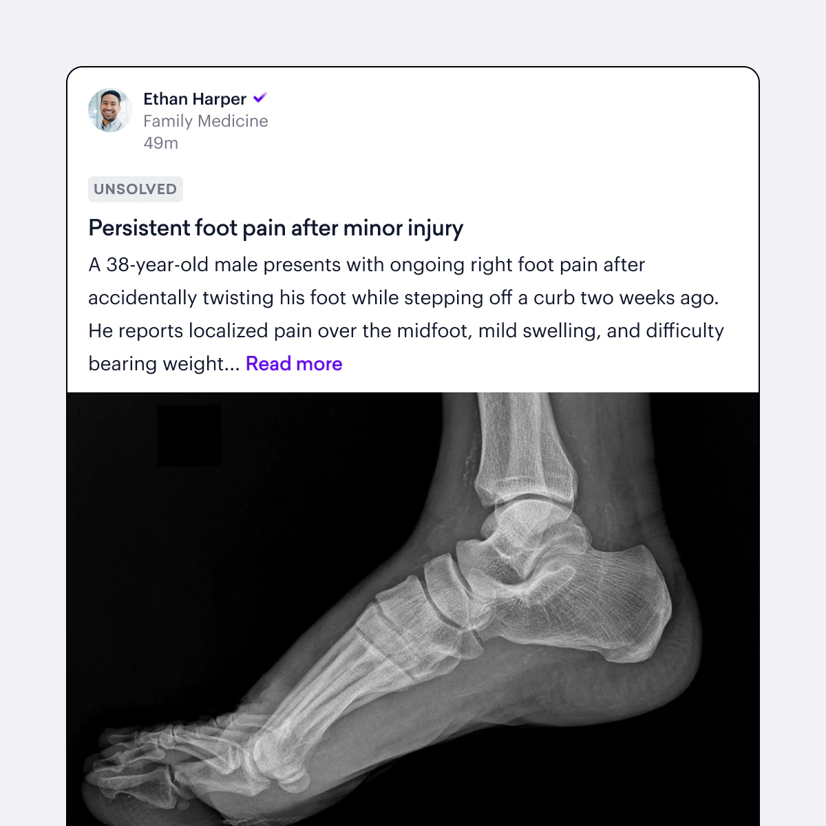 A Sermo physician's patient case post with an x-ray of a foot attached.