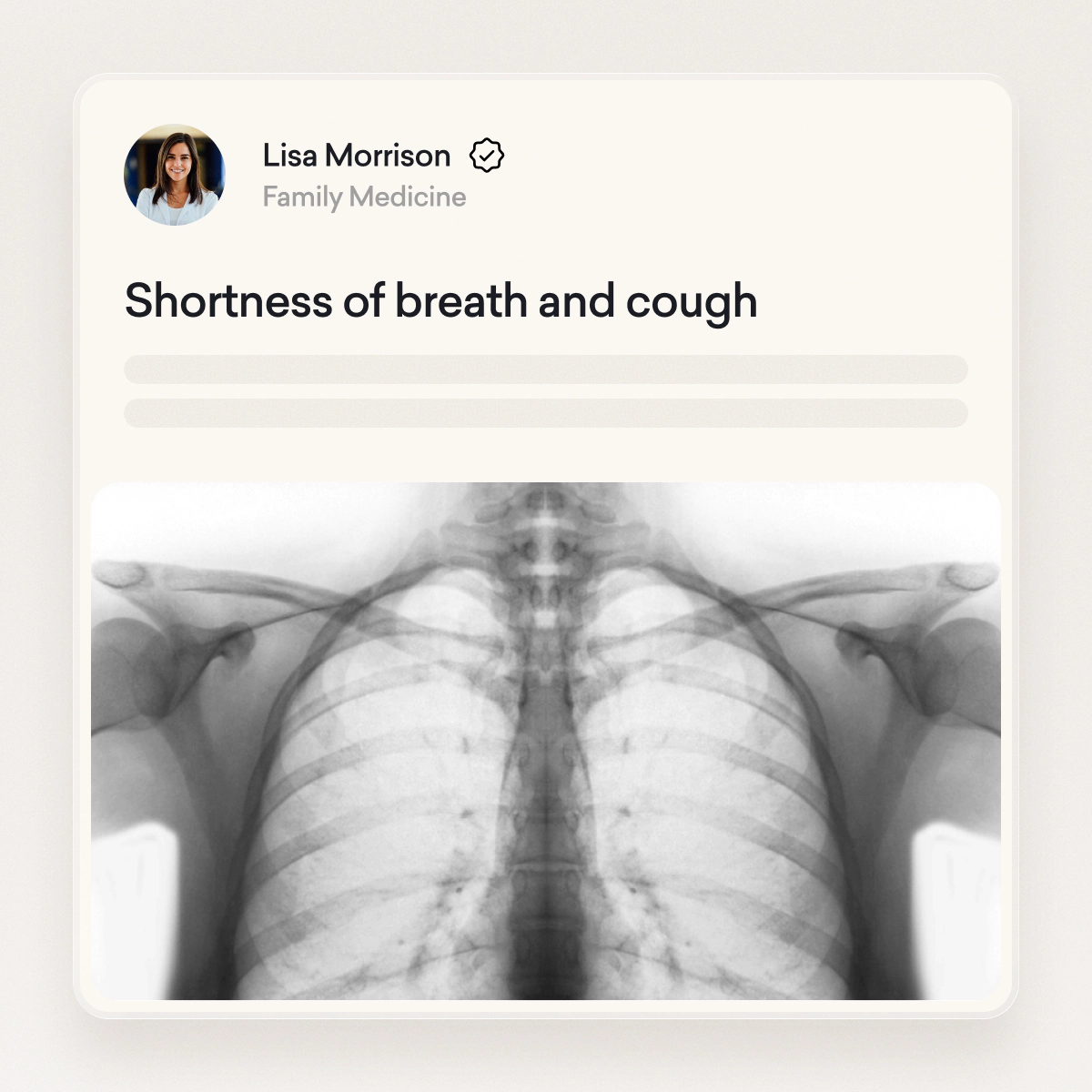 Chest X-ray image displayed below a medical note reading "Shortness of breath and cough" from a family medicine doctor named Lisa Morrison.